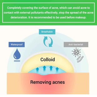 Acne Pimple Patch Stickers Acne Treatment Pimple Remover