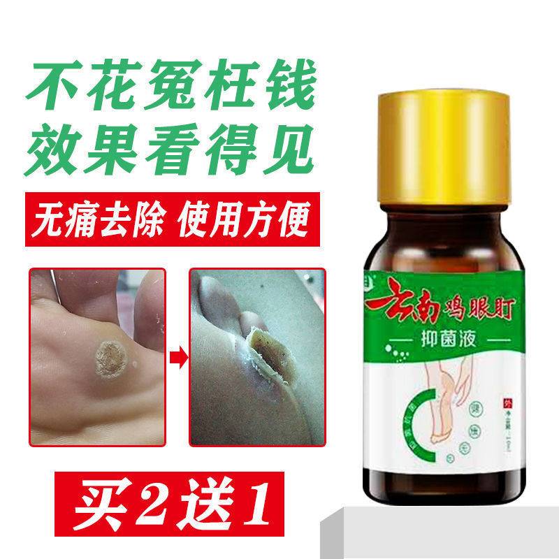 无痛去脚底手指缝小脚趾关节茧厚硬死皮脚指头脚缝老茧子鸡眼贴膏