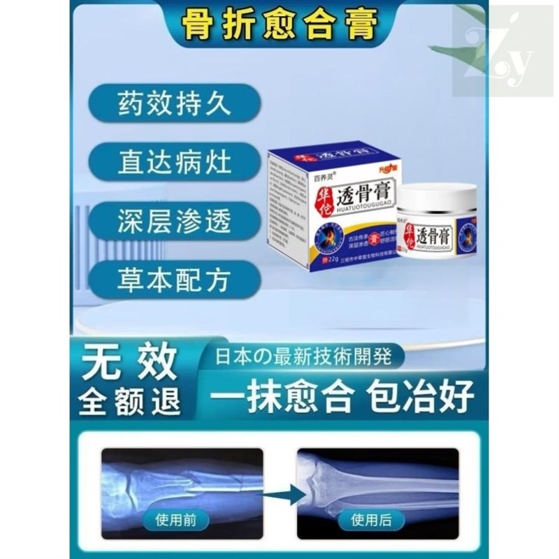 骨折骨裂恢复药跌打损伤活血化瘀B伤筋动骨消肿止痛全身可用特效
