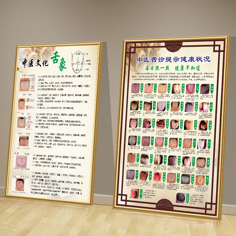 舌诊健康状况对照表图解中医养生馆挂图九种体质辨识X舌苔海报墙