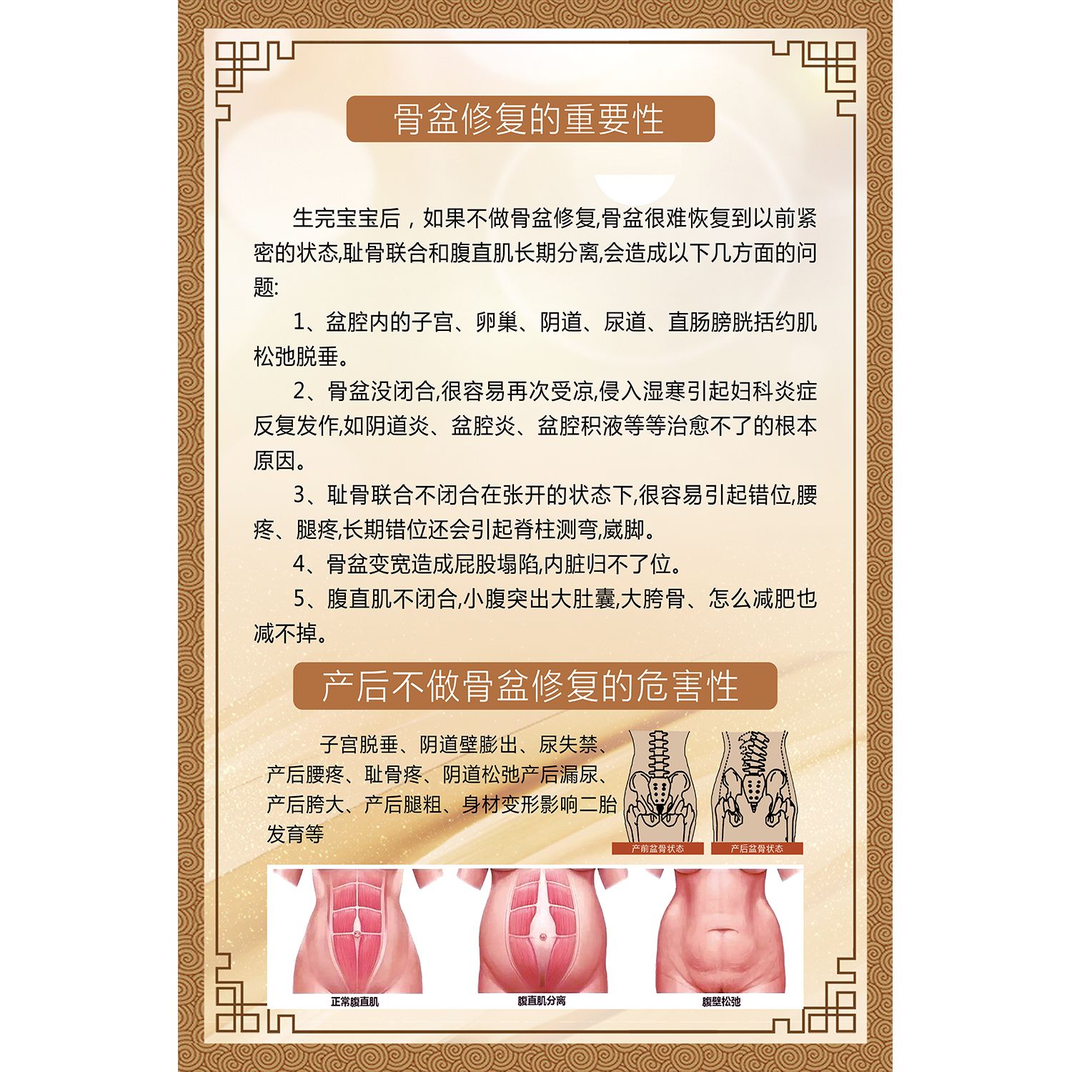 骨盆修复重要性海报广告美容院养生馆装饰画骨盆修复广告贴画贴纸