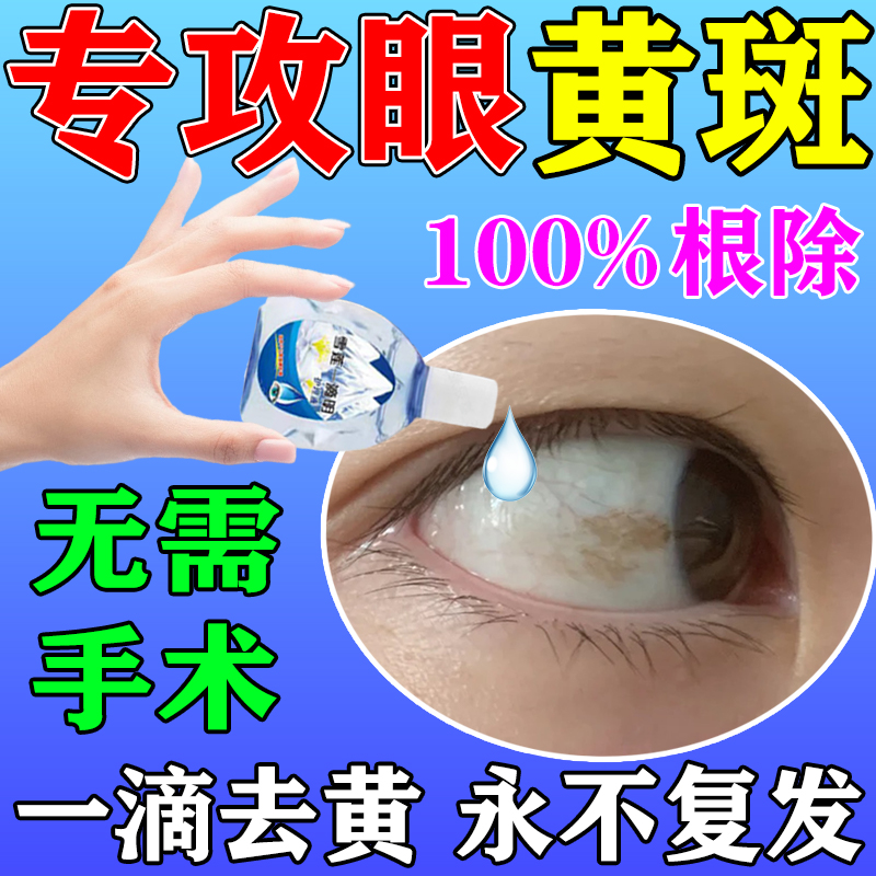眼白清澈去除眼底黄斑病变眼水去红血丝修复抗疲劳混浊滴眼液.