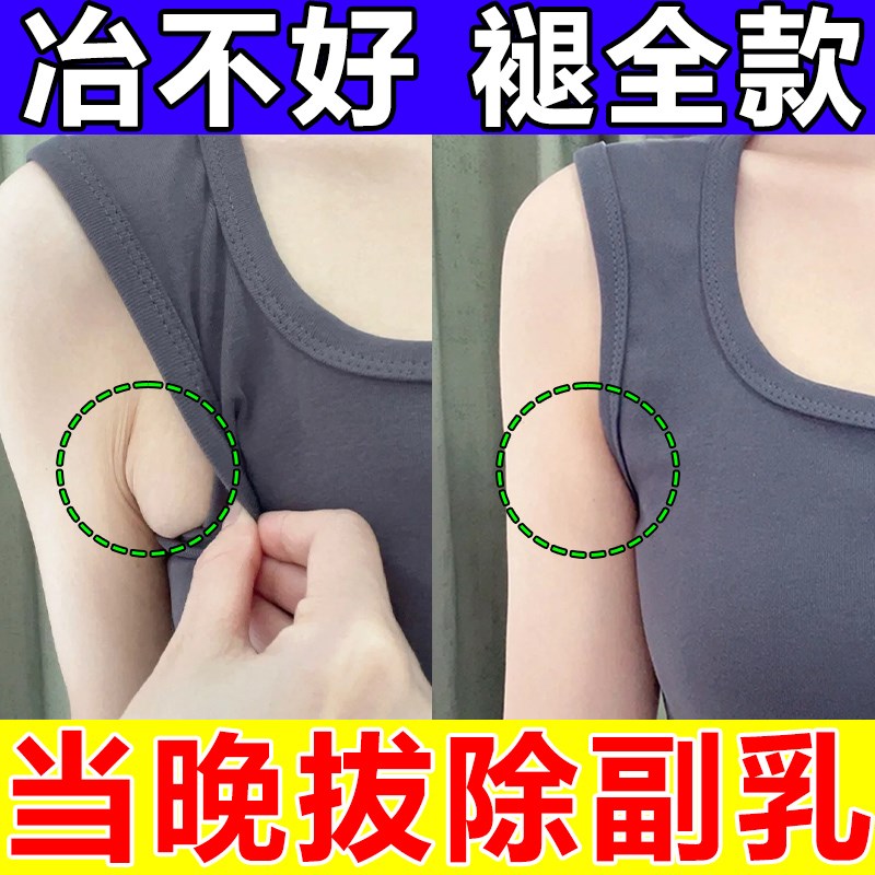 速发副乳贴去副乳神器贴收淋巴疏通器神结肿大消散膏腋下腋窝