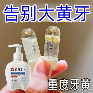 不用去洗牙【刷白了】快速美白美白珍珠粉亮白去渍去黄烟渍牙膏