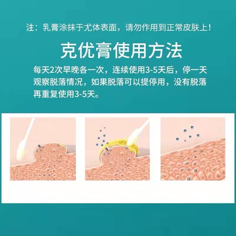 清疣膏丝状疣去脖子上长的猴子疣瘊小肉粒疙瘩一抹无忧祛去除神器