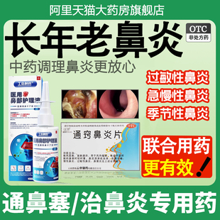 通窍鼻炎片正品中成药鼻塞鼻窦炎治疗鼻炎特效专用药官方旗舰店