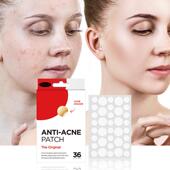 PATCH痘痘贴36粒痤贴水胶体透明隐形贴 ACNE 外贸 ANTI