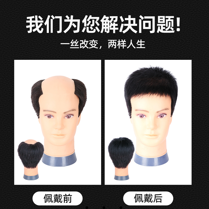 速发新款假发男短发毛寸韩版帅气全真人发男式头顶补发块男士假发