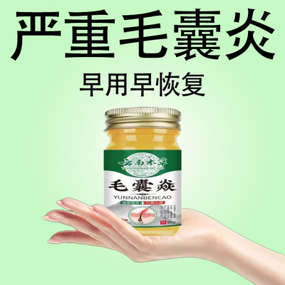 头部毛囊炎】头皮红肿发痒疼痛脓包肿胀痘痘丘疹分泌物多毛囊炎膏
