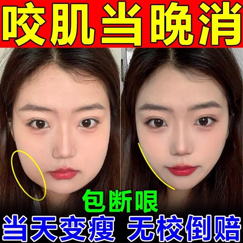 咬肌消除神器男士下颚线v脸提拉紧致收双下巴赘肉瘦脸溶脂去除器