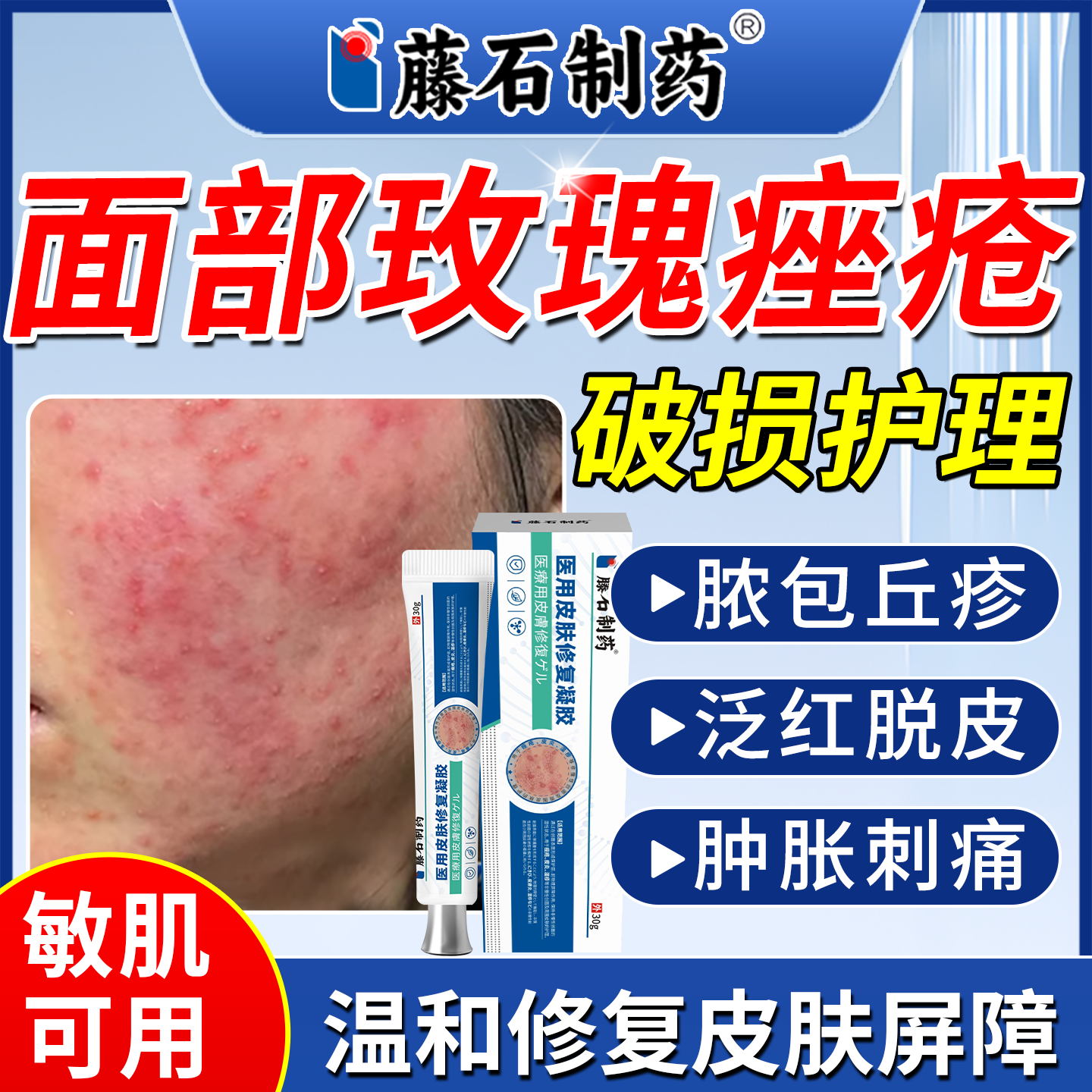 藤石制药脸部玫瑰痤疮下巴面部长痘粉刺医用型皮肤屏障修复凝胶OM