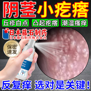 皮脂腺异位症阴茎囊jj小疙瘩白点脂肪颗粒潮湿瘙痒珍珠样丘疹OM