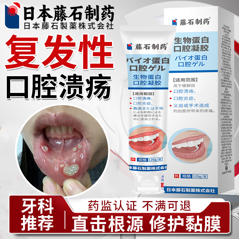 【日本监制】口腔溃疡专用