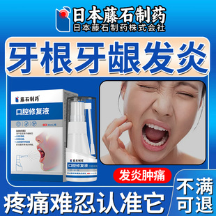 牙髓炎神经疼痛牙根发炎急慢性专用止牙龈上火肿痛蛀虫缓解喷剂OM