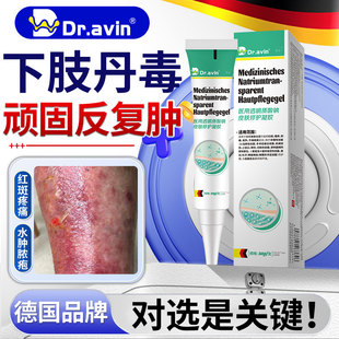 下肢丹毒消肿止痛流火皮肤红肿灼热小腿感染瘙痒专用膏药房同售OM