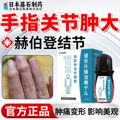 赫伯登结节专手指关节粗大变形肿大僵硬疼痛外用疙瘩可搭膏药OM