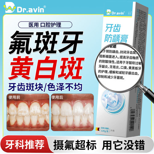 氟斑牙去除专用可搭配牙膏变白神器儿童牙齿白斑牙菌斑龋齿牙贴GH