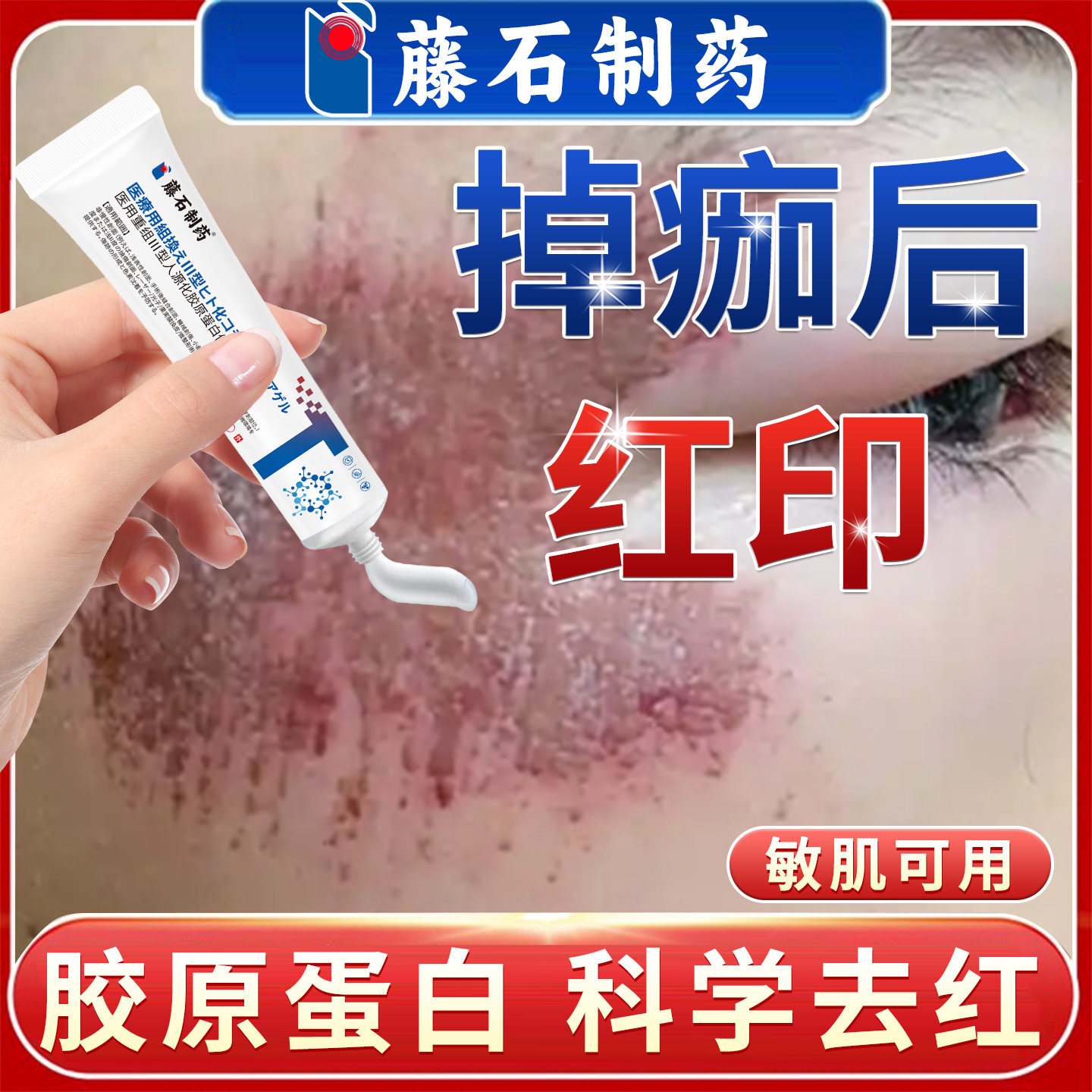 掉痂后红印疤痕修复擦伤摔伤祛疤膏结痂黑印儿童点痣后退红淡印GH图片