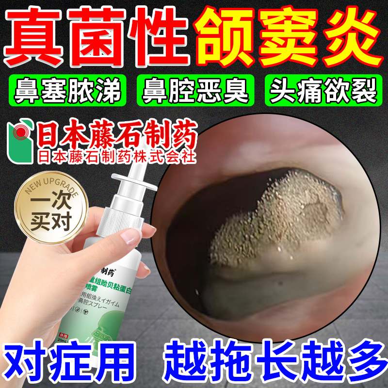 真菌性鼻窦炎排脓上颌窦炎头疼痛鼻塞通窍鼻腔恶臭喷剂药房同售OM