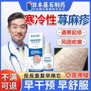 寒冷性荨麻疹慢性过敏止痒膏断遇根皮肤瘙痒湿疹风团医用喷剂OM