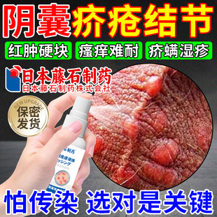 阴囊疥疮结节疥螨疥苍膏特硫磺软膏效除疥疮螨虫喷雾剂药监备案OM