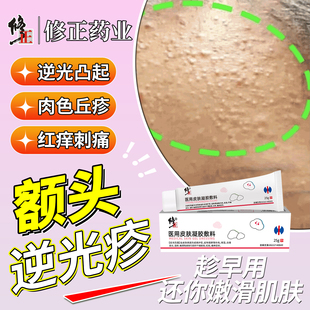 面部去逆光疹修复儿童脸上起小疙瘩闭口粉刺小颗粒屏障受损药膏OM