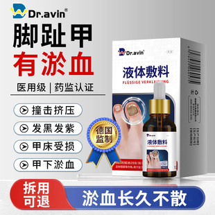 指甲淤血脚指甲被砸被夹发黑发紫变形手指甲床受损修复生长液EH