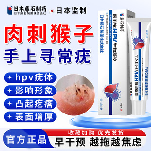 手指头长疣去寻常疣瘊子刺猴子除扁平疣一抹灵肉刺猴子药监备案FT