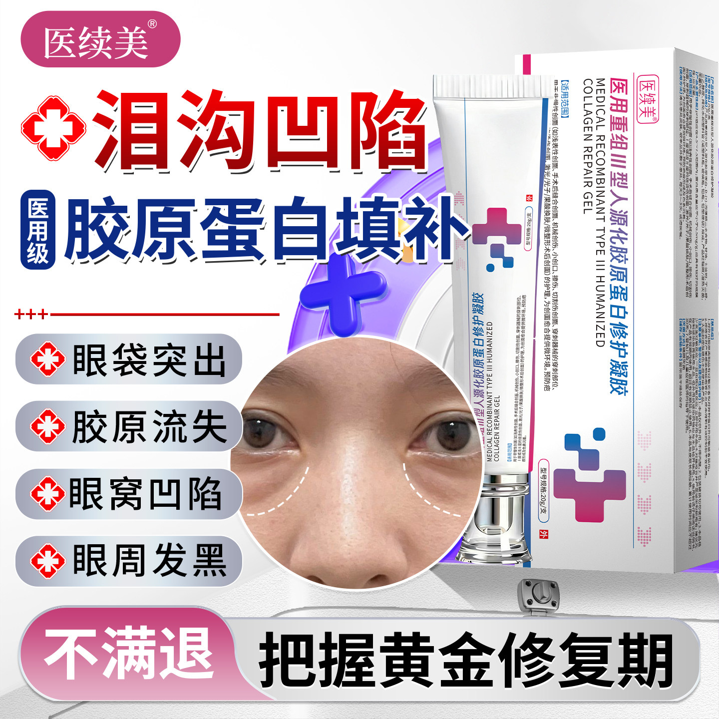 泪沟法令纹填充神器眼窝凹陷修复医用重组三型人源胶原蛋白凝胶OM