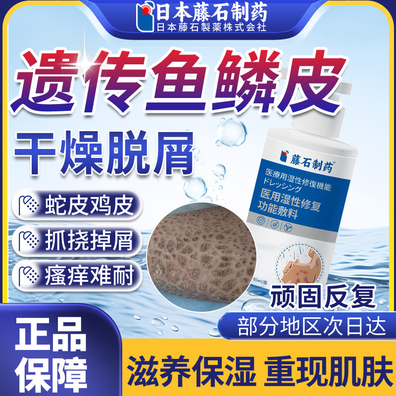 鱼鳞皮专用沐浴露滋润大腿手粗糙全身干燥瘙痒止痒去鸡皮蛇皮肤OM,医疗器械,保健理疗,淘宝优惠券,粉丝福利购,淘宝优惠卷