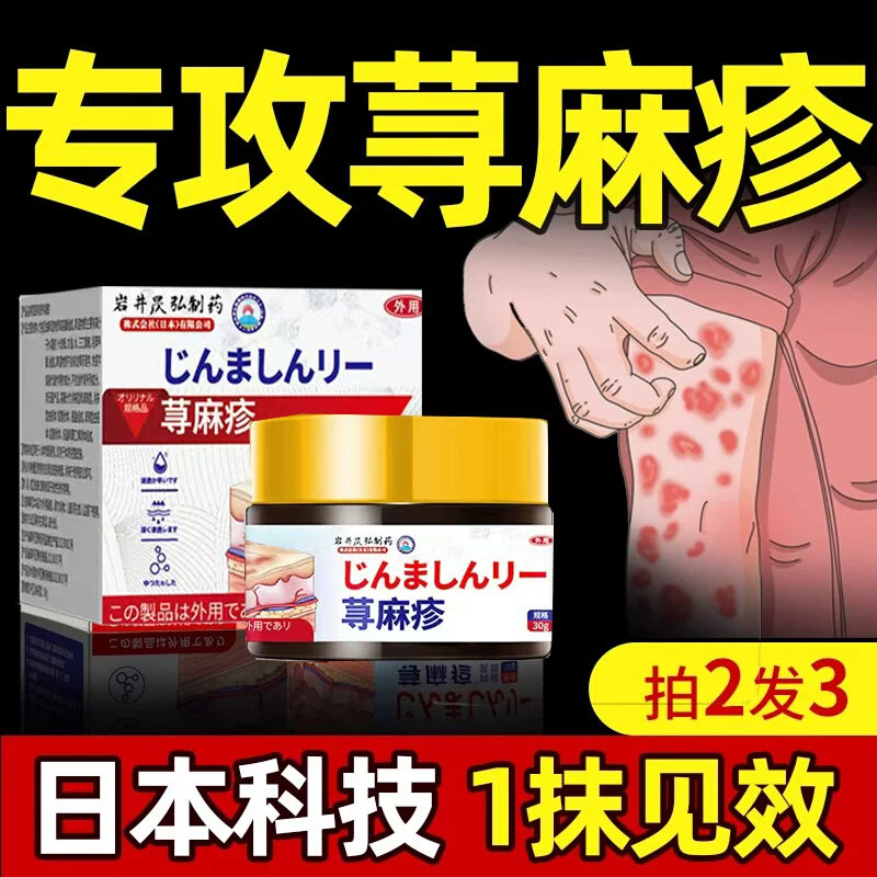 寻荨麻疹过敏止痒断根专用药治疗荨麻疹的特效药荨麻疹药膏寻荨麻疹过敏止痒断根专用药