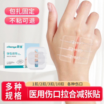减张贴医用皮肤减张贴剖腹产术后伤口拉合儿童用减张器拉合绷带