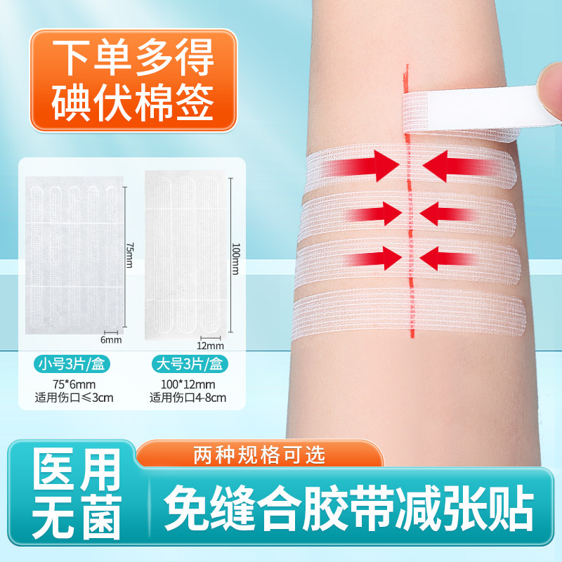 医用免缝合胶带减张器剖腹产术后伤口皮肤拉合儿童面部减张贴