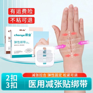 减张贴医用皮肤剖腹产伤口贴儿童术后小伤口贴减张器