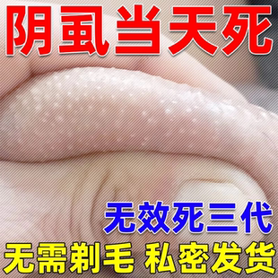 男女通用私处去除虱子虱卵百部酊灭阴虱虱立净喷剂 阴虱一扫光正品