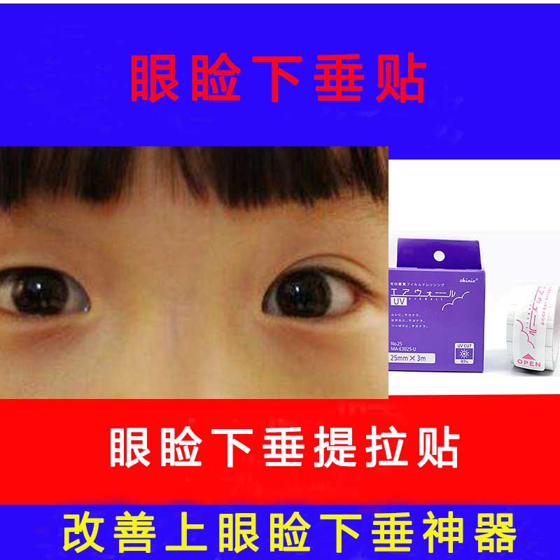 速发小孩上眼睑下垂提拉贴矫正贴矫正胶带儿童上睑下垂悬吊纠正