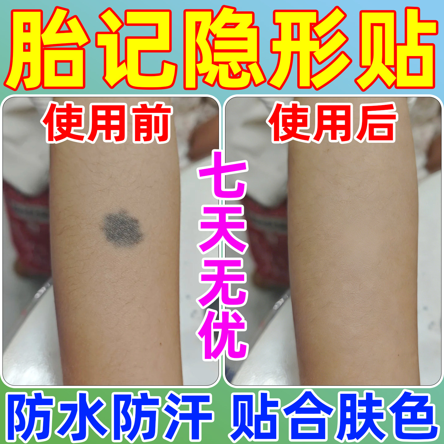 瑕胎隐形贴纹身遮盖贴遮疤痕淤青神器肉色遮挡遮记防水防汗遮瑕贴