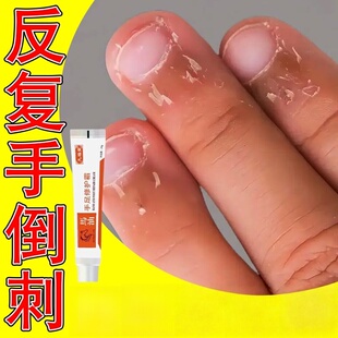 手指倒刺修复指甲边缘长肉刺防学生儿童手指上起倒刺干皮脱皮神器