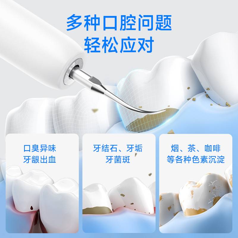 月儿弯弯超声波洁牙器家用智能超声波洗牙器除牙石个人护理美牙仪