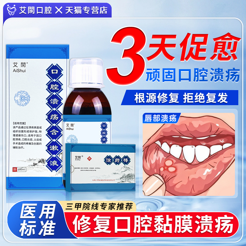 艾閖口腔溃疡含漱修复液漱口水特专用效非药膏喷剂雾一点灵贴凝胶