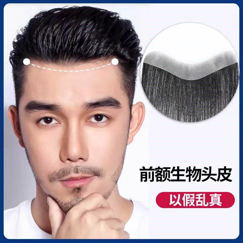 发际线假发贴男士刘海前额补发片自然隐形真发M型额头真人刘海片