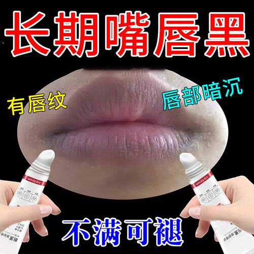 改善唇周黑嘴角暗沉去除嘴巴周边黑乌唇膜膏去死皮淡化唇纹部护理