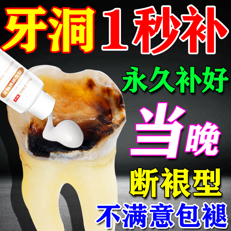 牙洞填补膏永久补牙齿缝隙美国进口神器自己在家填充堵烂洞修复液