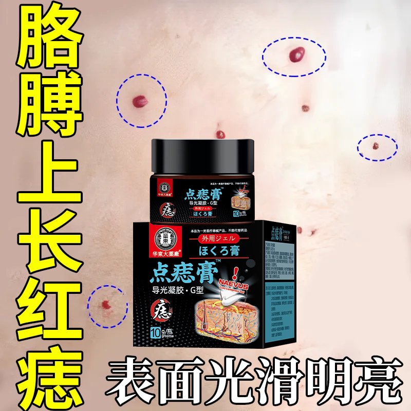 胳膊上长红痣鲜红樱桃色血管瘤交界痣混合痣皮内痣色素痣血膏vzd