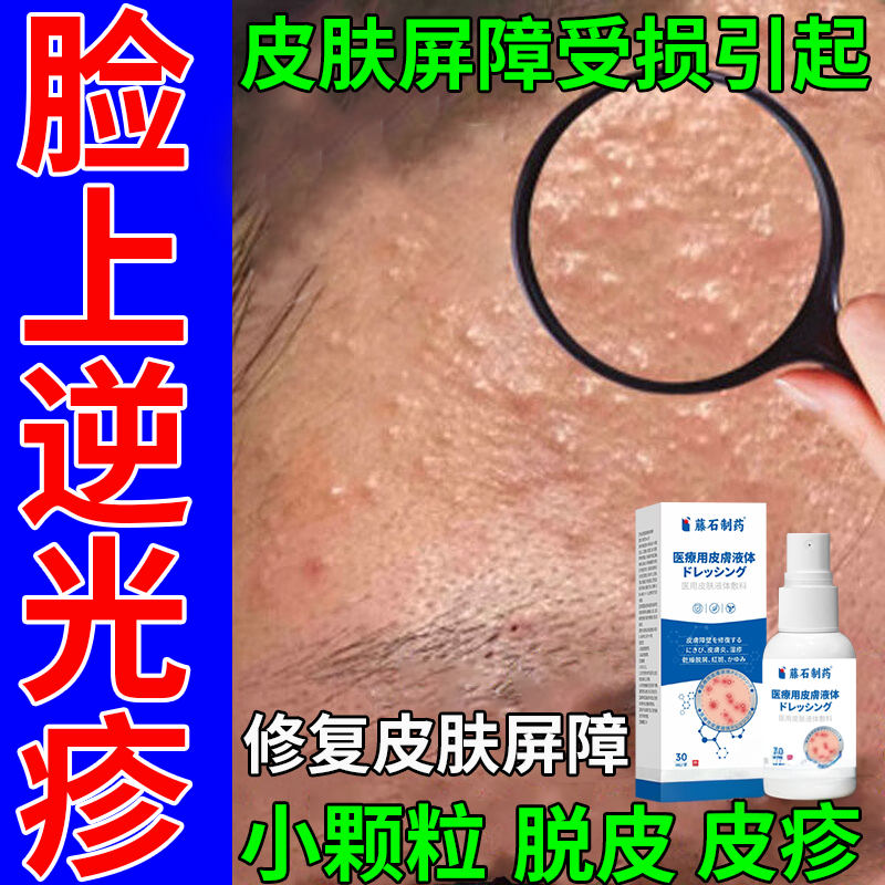 脸上额头小颗粒小疙瘩逆光疹毛囊炎屏障受损儿童闭口粉刺激素脸RW