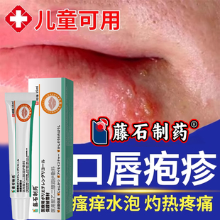 口唇疱疹嘴巴上火起泡烂嘴角单纯性嘴唇开干裂脱皮剥落性膏贴炎RW