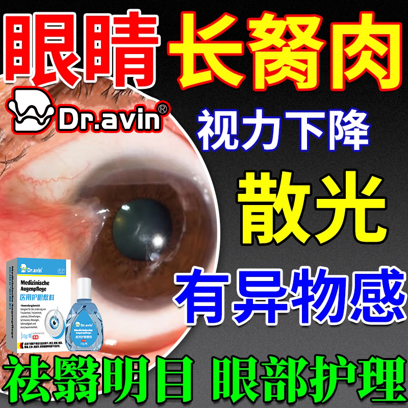 眼角长翼状胬肉模糊眼花流泪