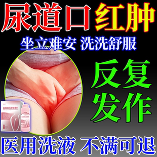 尿女性尿道口红肿尿道炎尿路感染外用洗液尿频尿急膀胱私处瘙痒VZ