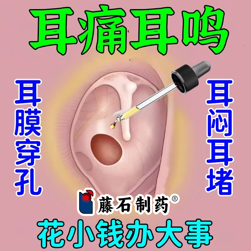 外伤耳膜穿孔滴耳液中耳炎神经性耳鸣听觉受损耳积液RW