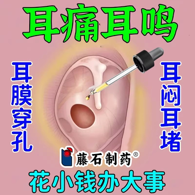 外伤耳膜穿孔滴耳液中耳炎神经性耳鸣听觉受损耳积液RW